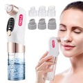 TYMO Bubble Facial Blackhead Removal Vacuum Face Cleaner