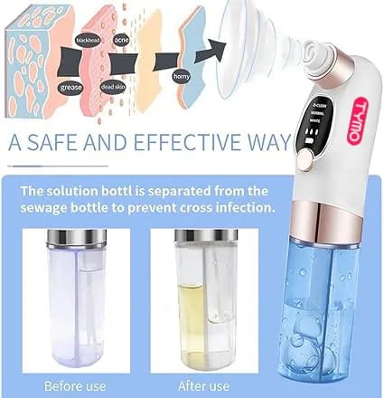 TYMO Bubble Facial Blackhead Removal Vacuum Face Cleaner