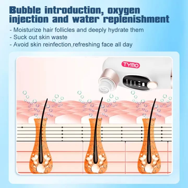 TYMO Bubble Facial Blackhead Removal Vacuum Face Cleaner
